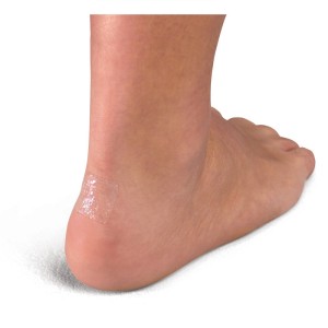 More Skin - podkładki hydrożelowe Mueller