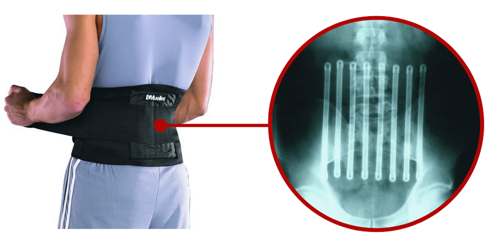 Regulowana orteza na plecy lędźwiowo-krzyżowa Mueller