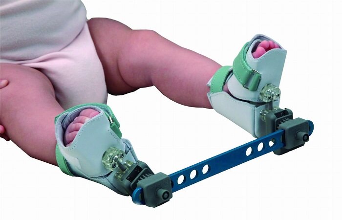 Szyna korekcyjna Denis Browna TIBAX PRIM